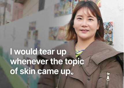 누가 피부 얘기만 꺼내도 눈물이 났어요.