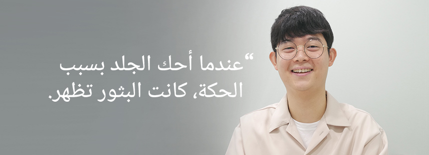 عندما خدشت بسبب الحكة، كانت تظهر بثور.