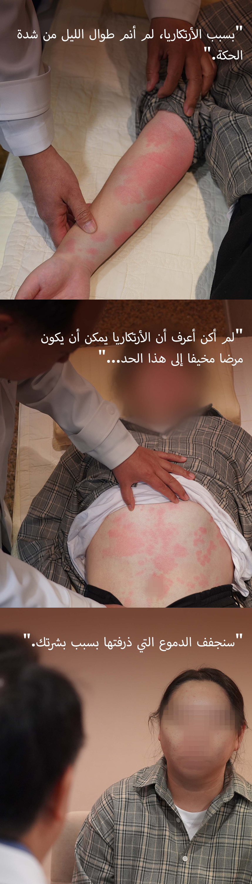 لم أستطع النوم على الإطلاق الليلة الماضية لأنني كنت أخدش خلايا النحل.