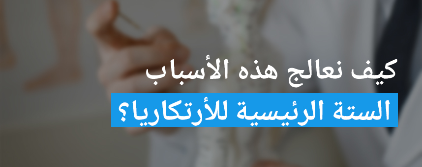 كيف نعالج هذه الأسباب الستة الرئيسية للأرتكاريا؟