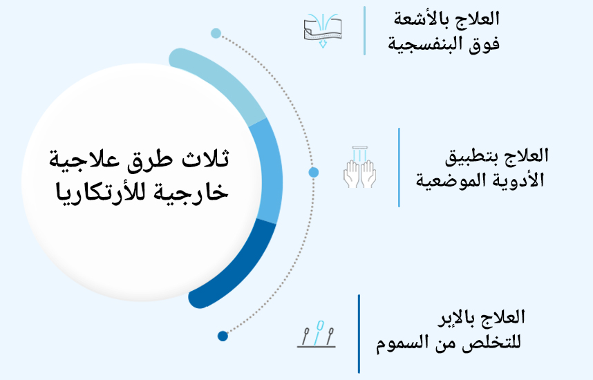 العلاجات الخارجية الثلاثة الرئيسية للأرتكاريا