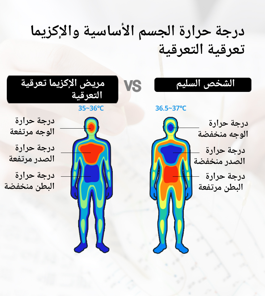 درجة حرارة الجسم الأساسية والإكزيما النقطية