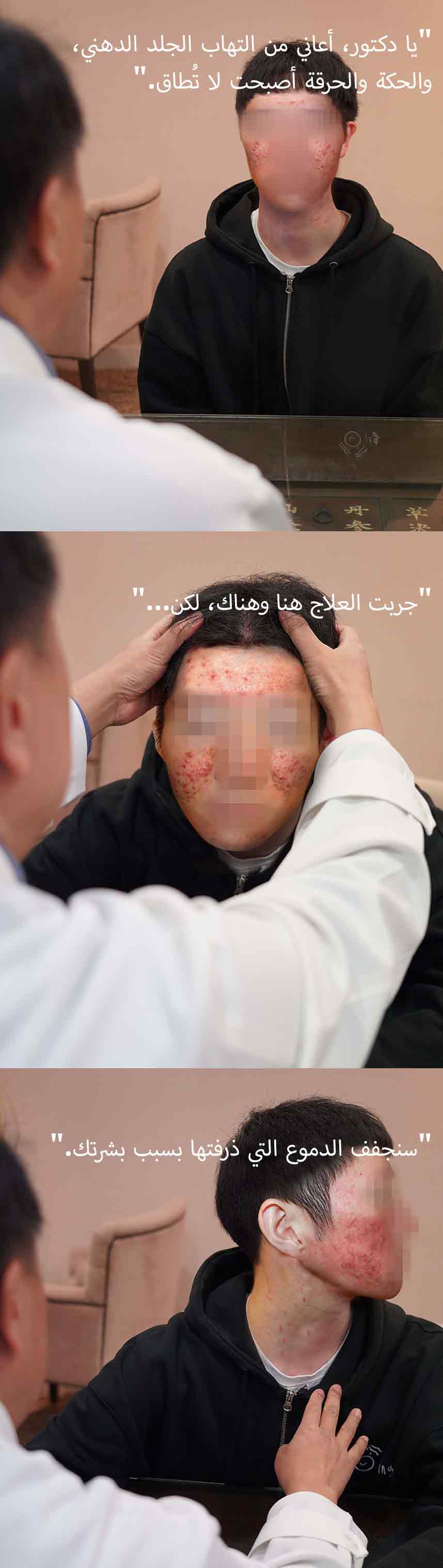 دكتور، التهاب الجلد الدهني لدي مؤلم جدًا ويشعر بالحرق.