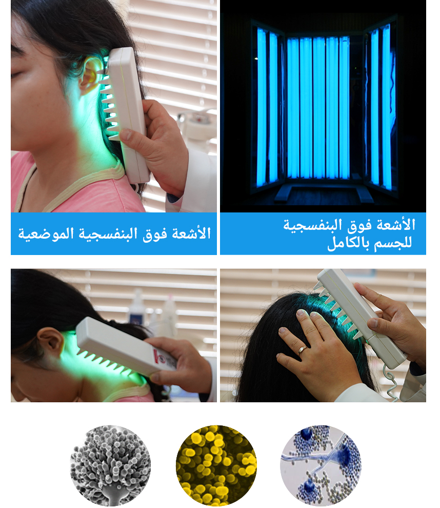علاج بالأشعة فوق البنفسجية الموضعية ,علاج بالأشعة فوق البنفسجية للجسم بالكامل
