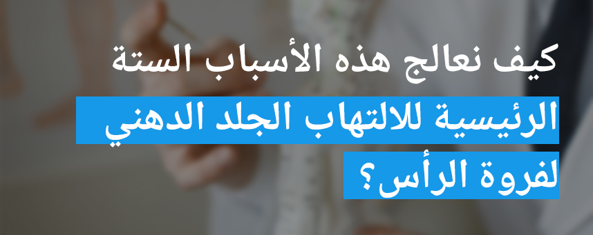 كيف نعالج هذه الأسباب الستة الرئيسية للالتهاب الجلد الدهني لفروة الرأس لفروة الرأس؟