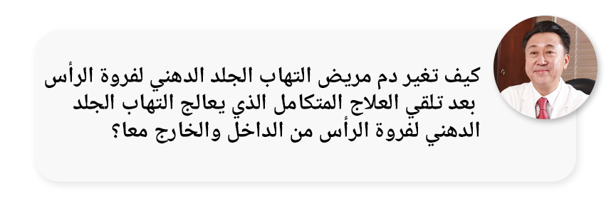 كيف تغير دم مرضى التهاب الجلد الدهني لفروة الرأس لفروة الرأس بعد علاج التهاب الجلد الدهني لفروة الرأس لفروة الرأس المتكامل الذي يعالج العوامل الداخلية والخارجية؟