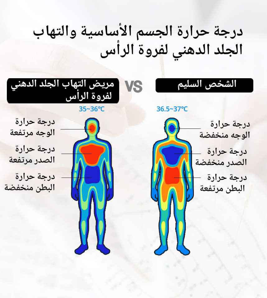 درجة حرارة الجسم الأساسية والتهاب الجلد الدهني لفروة الرأس لفروة الرأس