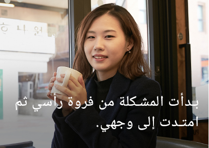 بدأ الأمر من رأسي وانتشر إلى وجهي.