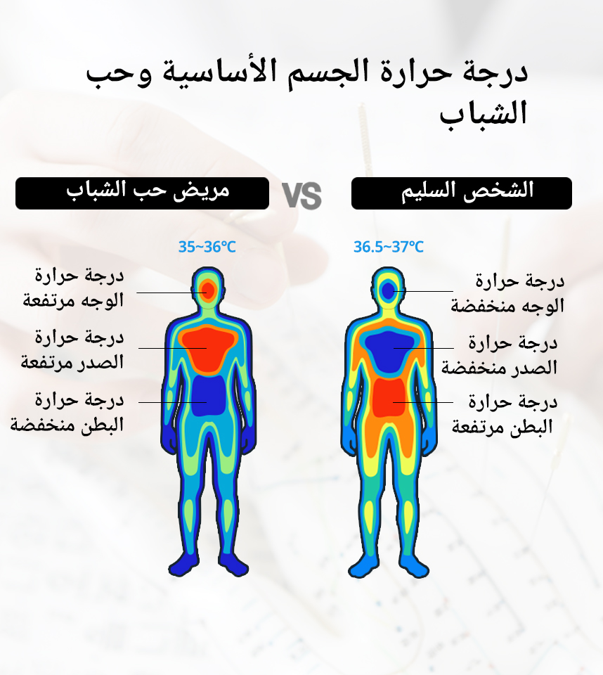 درجة حرارة الجسم الأساسية وحب الشباب