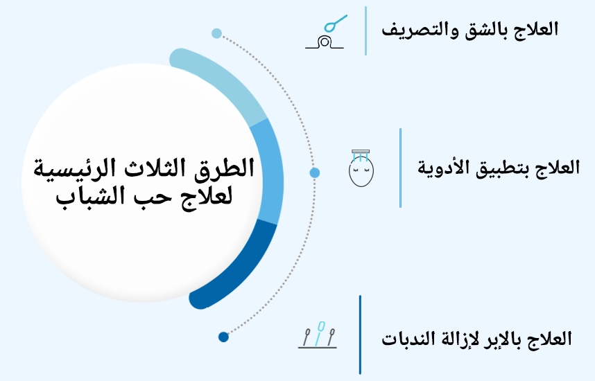 العلاجات الخارجية الثلاثة الرئيسية للحب الشباب