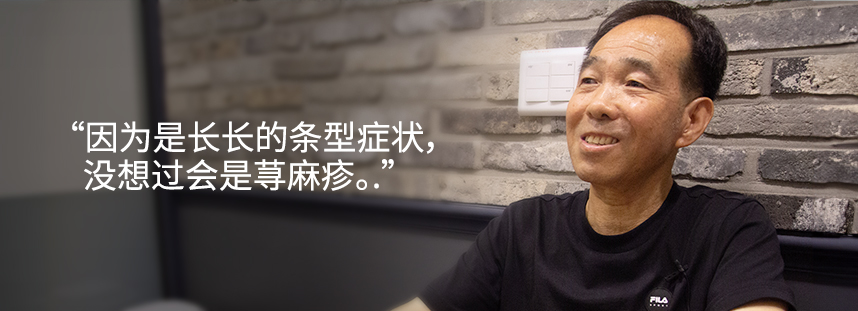 The rash looked like long lines, so I didn’t think it was hives.