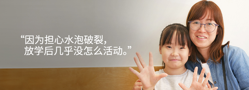 I could hardly participate in after-school activities, afraid the blisters might burst.