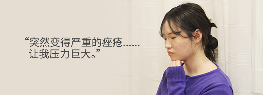 The sudden worsening of my acne was so stressful.