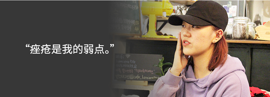 Acne was my biggest weakness.