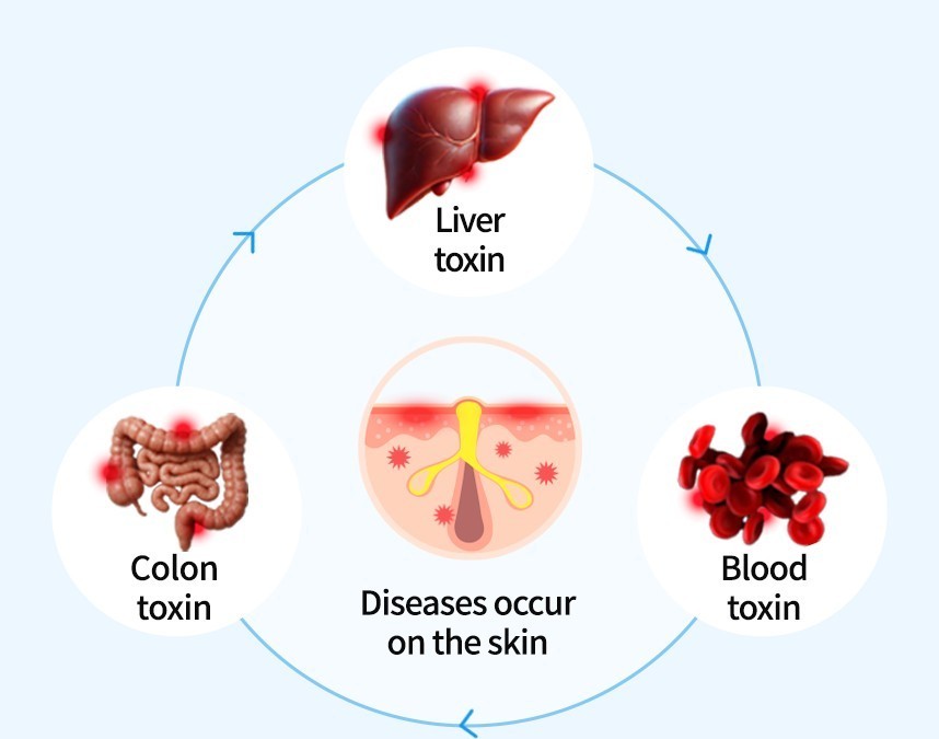 건선 피부의 발생과정