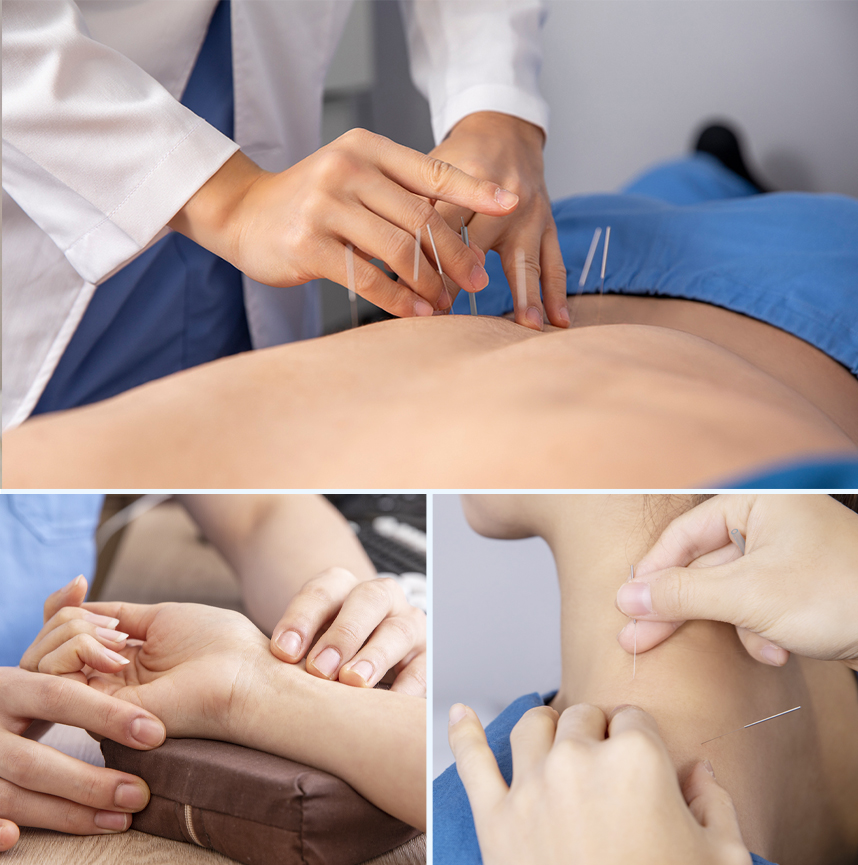 해독침치료를 받는 건선환자