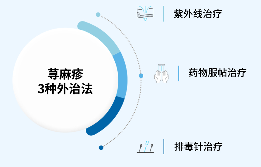 The Three Major External Treatments for Urticaria 
