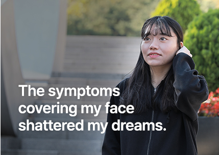 얼굴을 뒤덮은 증상, 꿈이 무너졌어요.