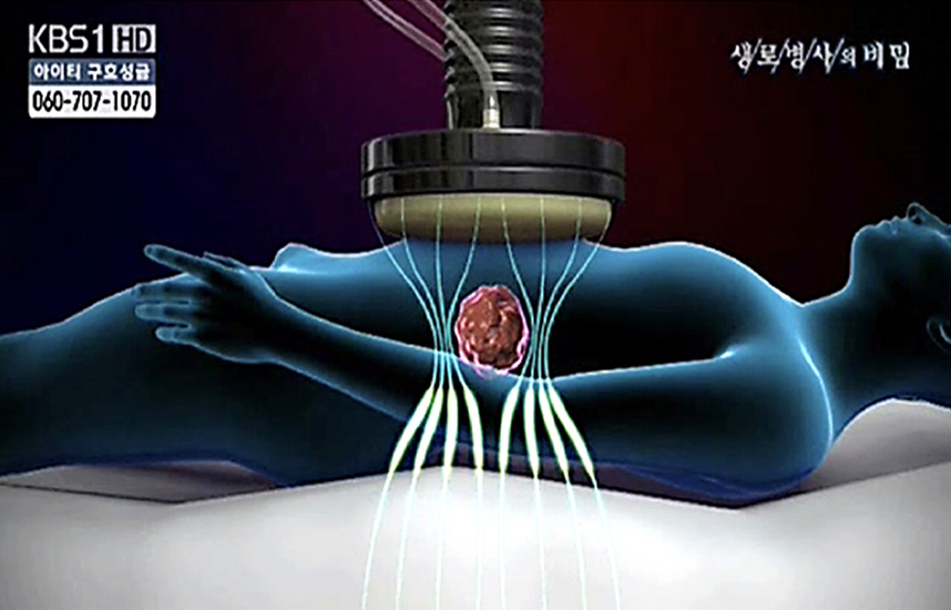 High-Frequency Thermal Therapy
