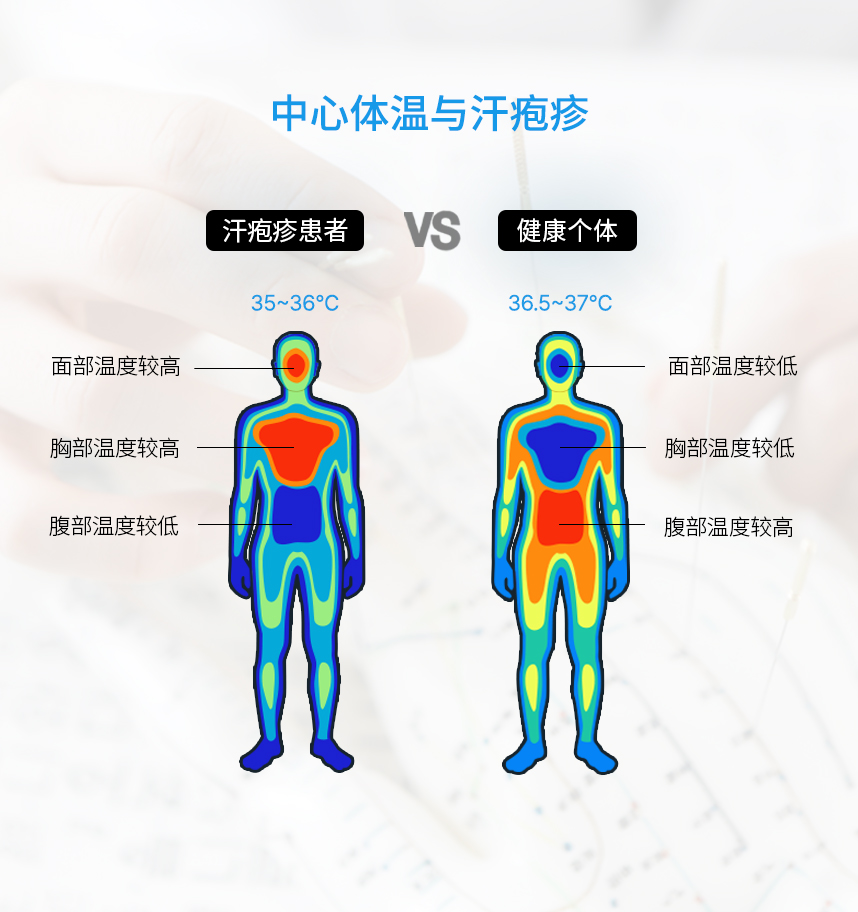 Core Body Temperatureand Psoriasis