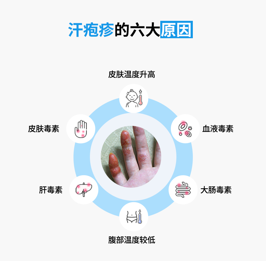 The Six Major Causes of dyshidrotic eczema