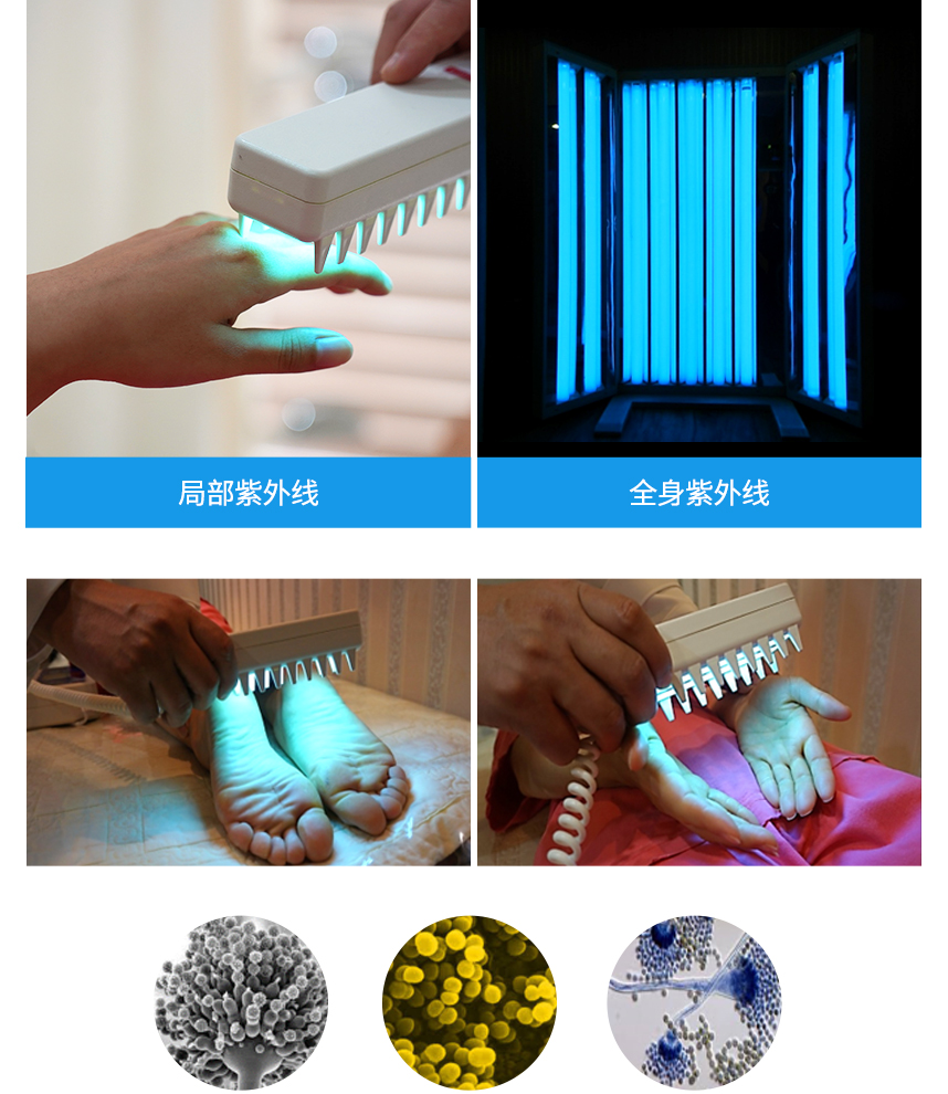 Ultraviolet Treatment