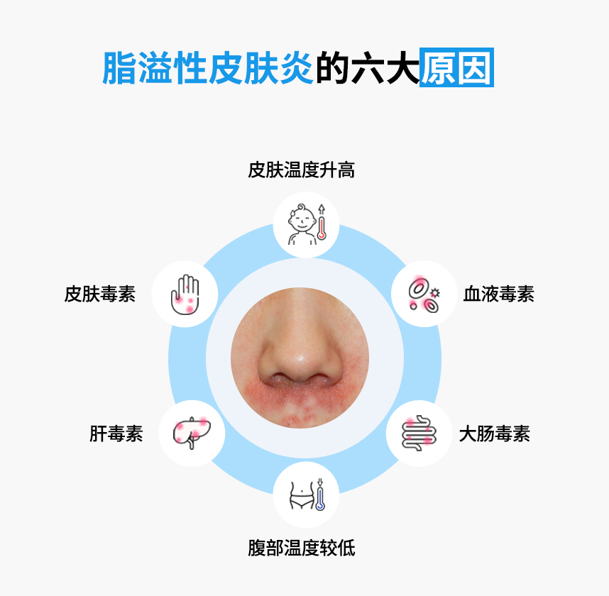 The Six Major Causes of Seborrheic Dermatitis