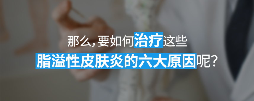 How do we treat these six major causes of seborrheic dermatitis?