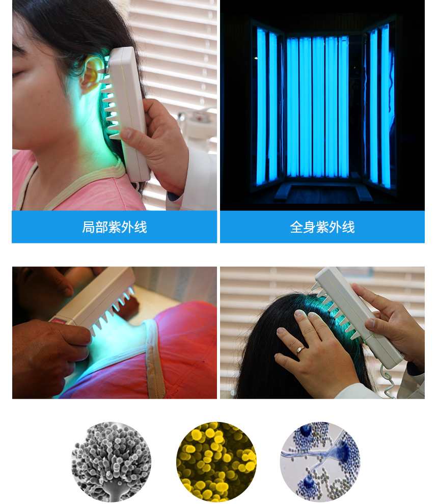 Ultraviolet Treatment