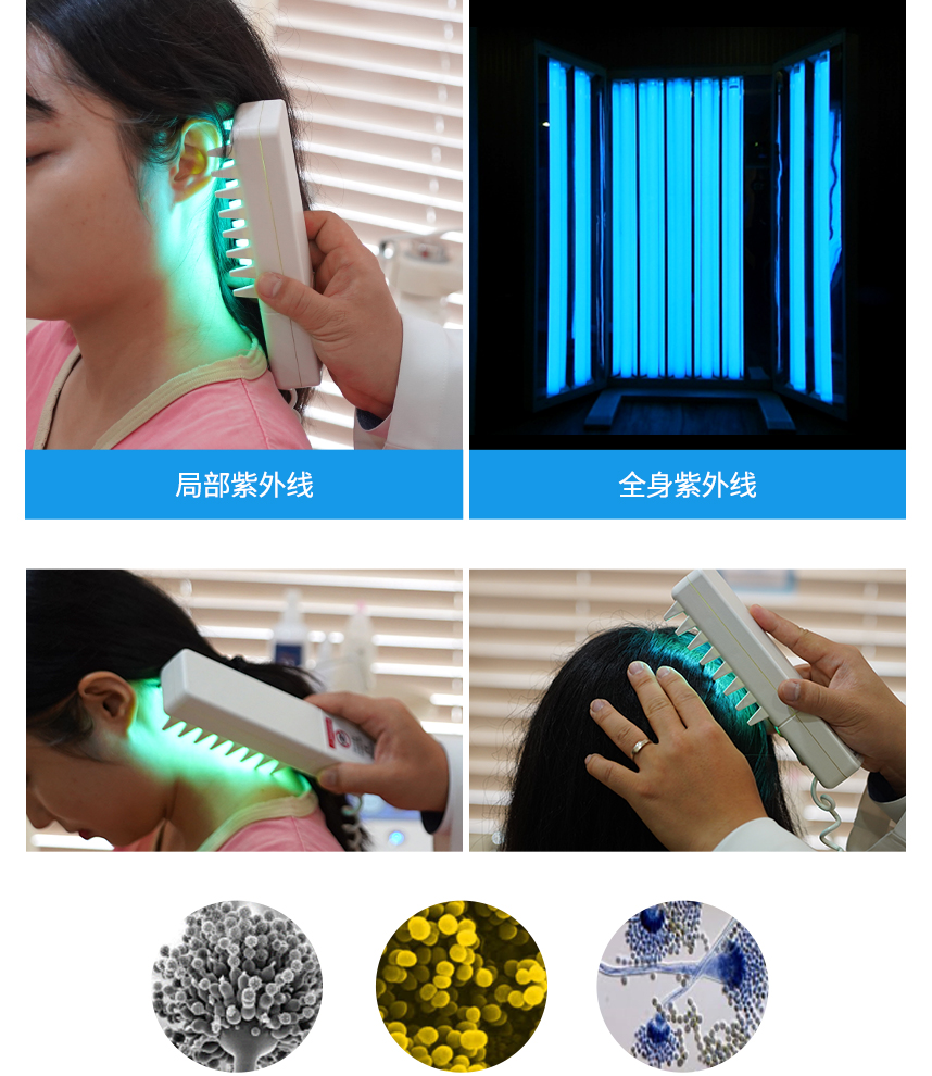 Ultraviolet Treatment