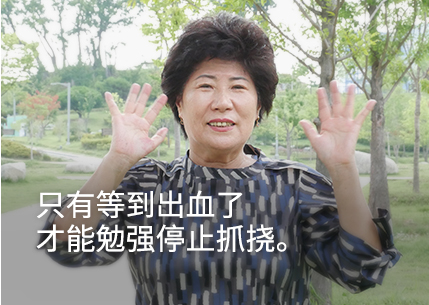 I would only stop scratching once I started bleeding.