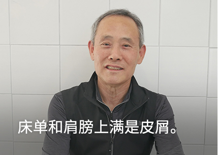 My sheets and shoulders were covered in flakes.