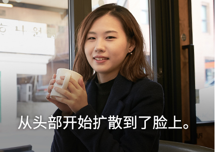 It started from my head and spread down to my face.