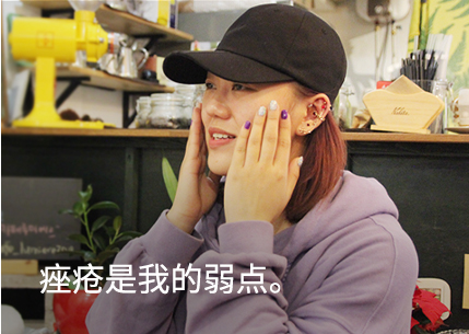 Acne was my biggest weakness.