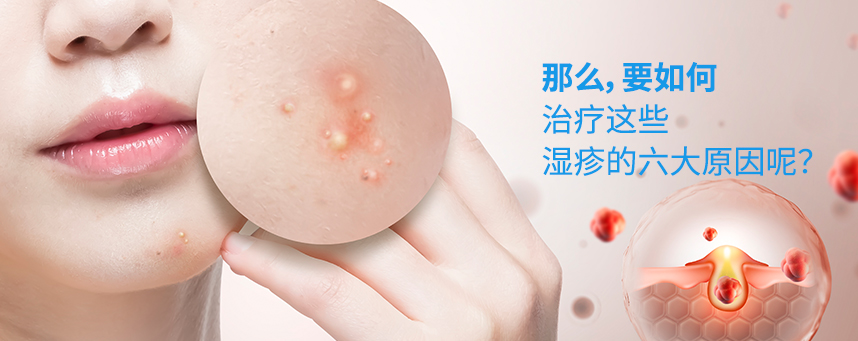 How do we treat these six major causes of acne? 