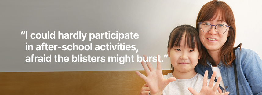 I could hardly participate in after-school activities, afraid the blisters might burst.