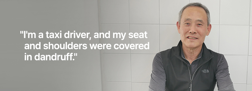 I'm a taxi driver, and my seat and shoulders were covered in dandruff.