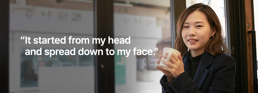 It started from my head and spread down to my face.