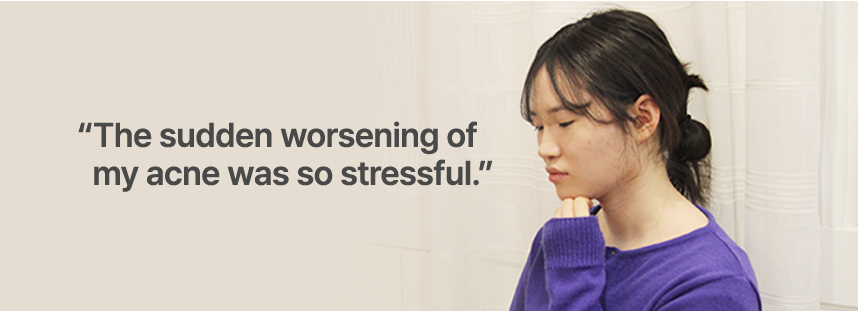 The sudden worsening of my acne was so stressful.