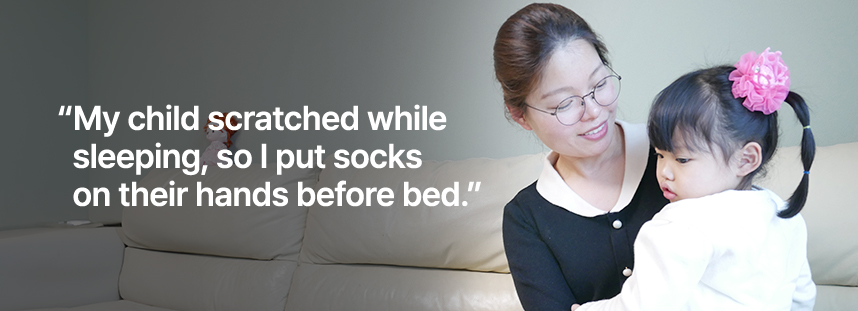 아이가 자면서 긁어서 양말을 손에 씌우고 재웠어요.