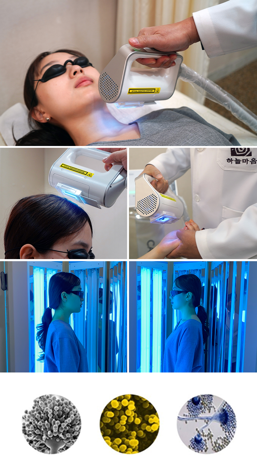 광선치료를 받는 습진환자