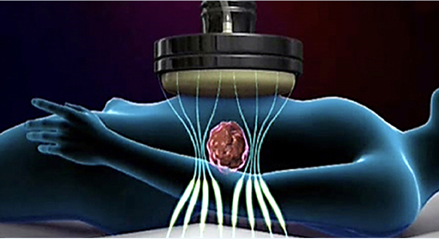 약물도포치료를 받는 습진환자