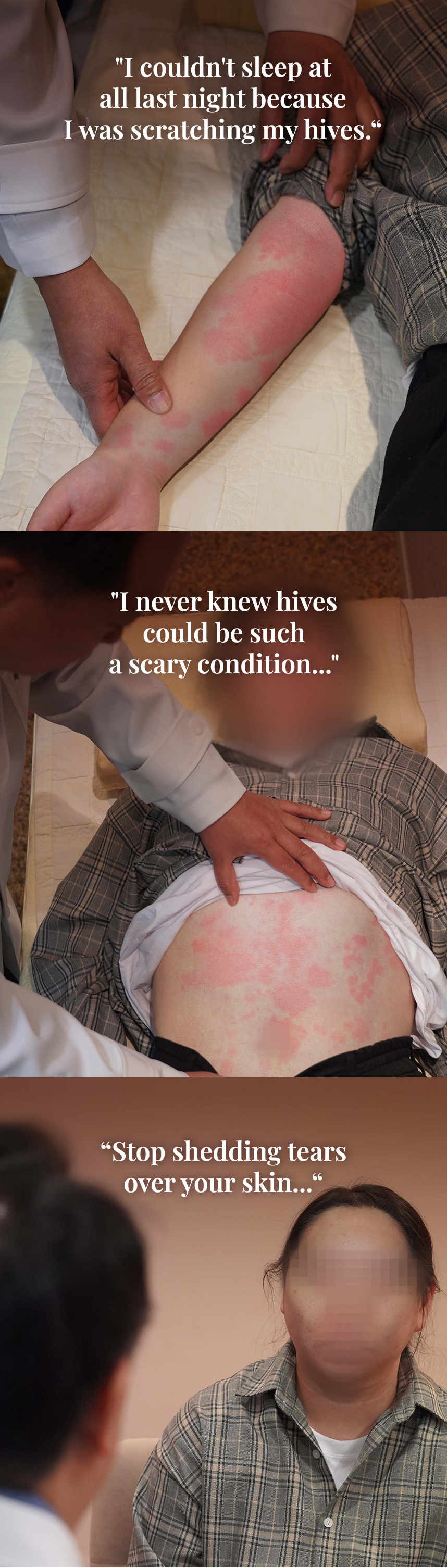 I couldn't sleep at all last night because I was scratching my hives. I never knew hives could be such a scary condition... Stop shedding tears over your skin...