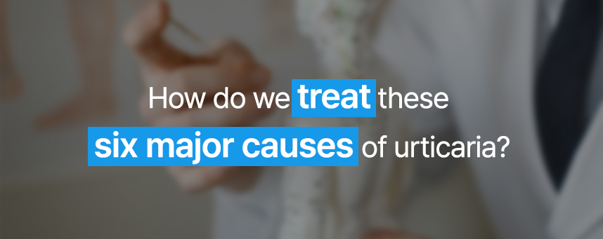 How do we treat these six major causes of urticaria? 