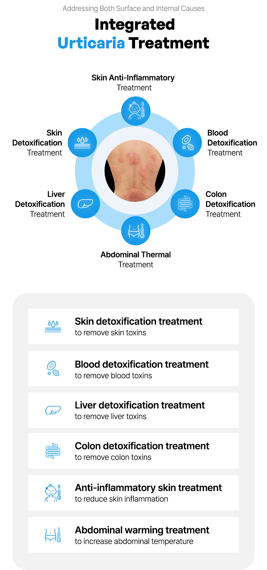 Integrated Urticaria Treatment