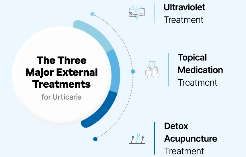 The Three Major External Treatments for Urticaria