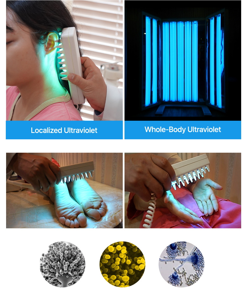 Ultraviolet Treatment