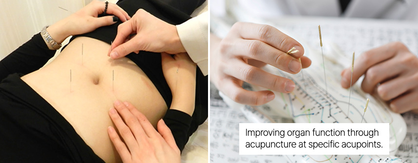 Improving organ function throughacupuncture at specific acupoints.