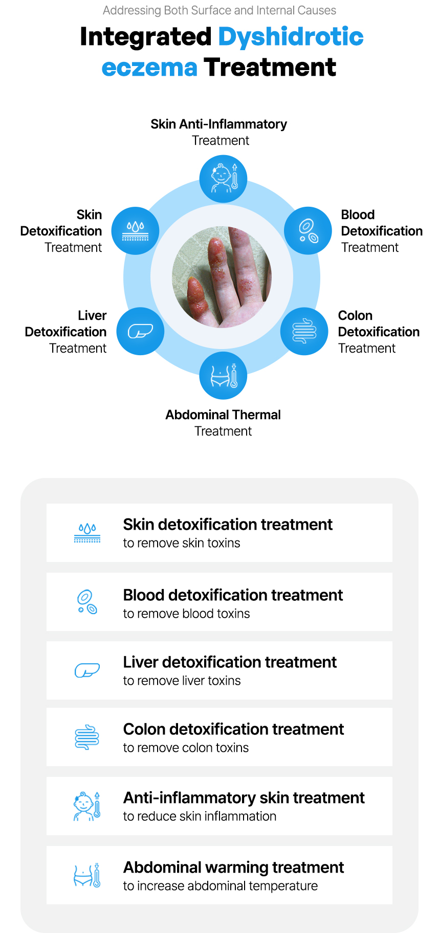 Integrated dyshidrotic eczema Treatment