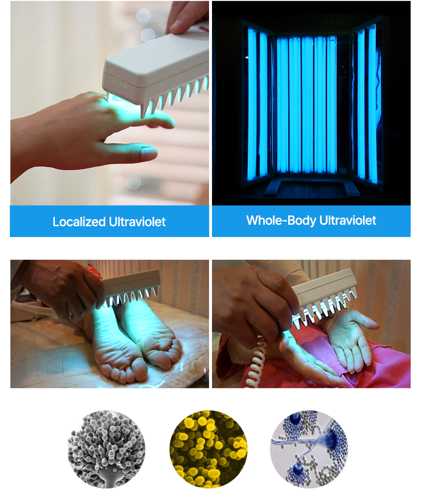 Ultraviolet Treatment